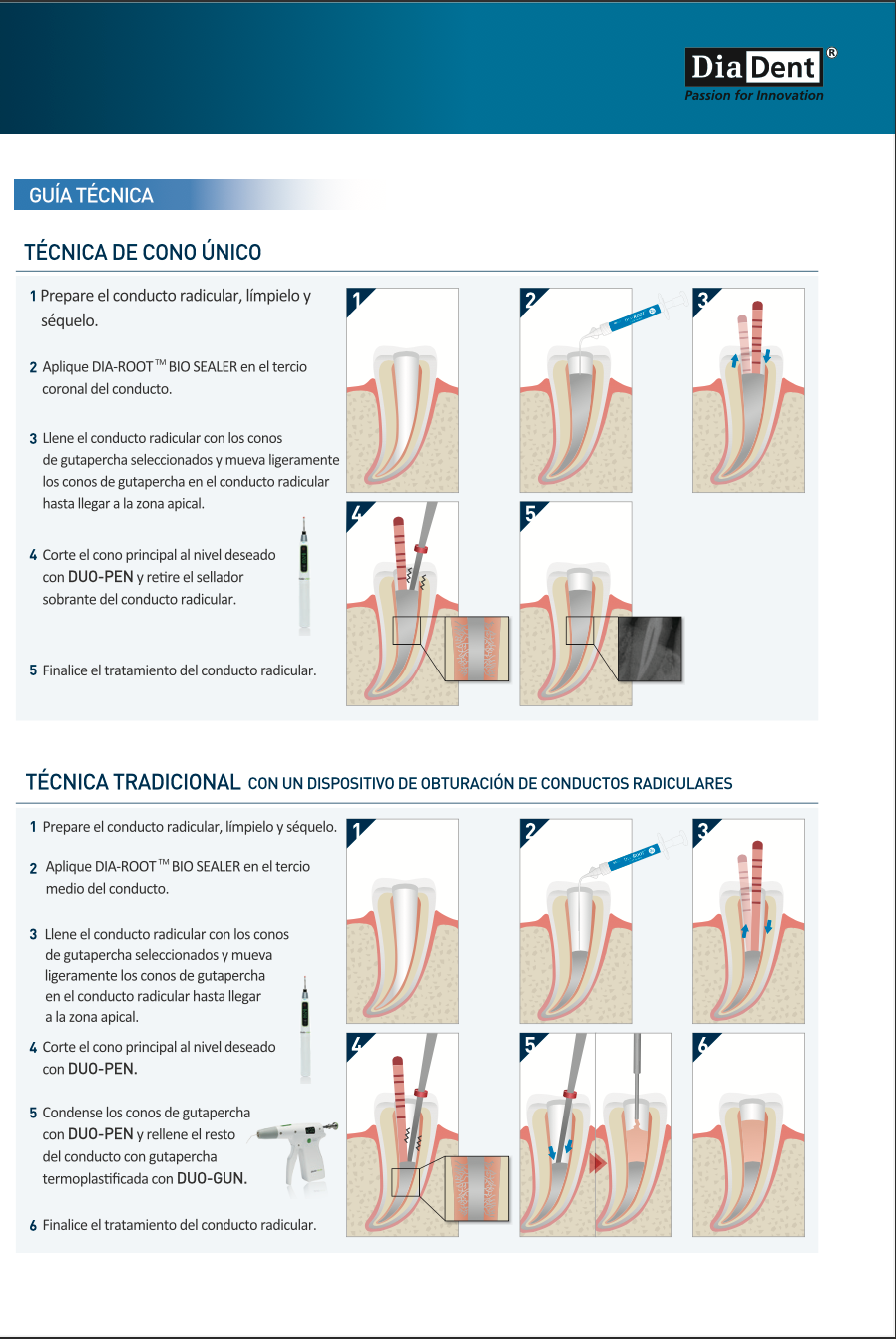 Paquete de 3 jeringas de Dia-Root BIO Sealer Mta Bio Ceramico Promocion