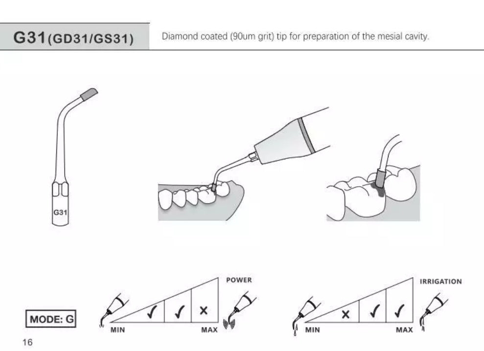 LD 31punta con irrigacion para preparacion de la cavidad en Mesial