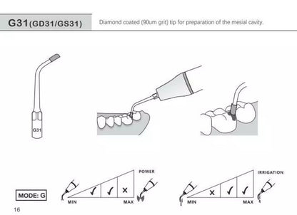 LD 31punta con irrigacion para preparacion de la cavidad en Mesial